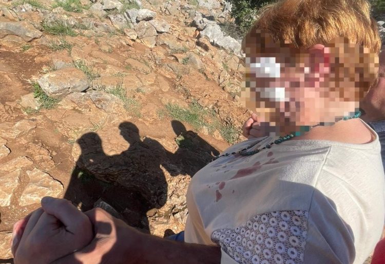 Hodočasnica iz Njemačke ozlijeđena na Brdu ukazanja