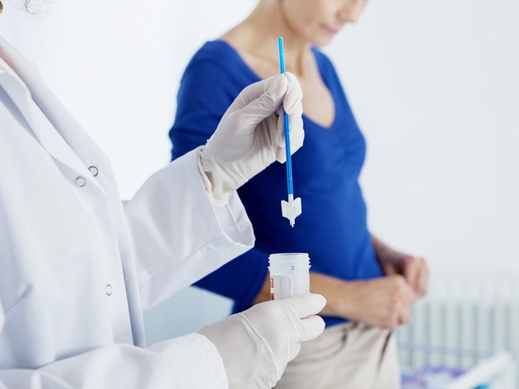 Papa test: Jednostavan pregled koji može spasiti život
