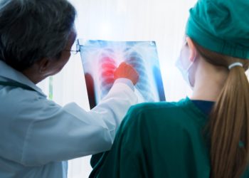 Nova studija: Evo što povećava rizik od raka pluća, čak i kod nepušača