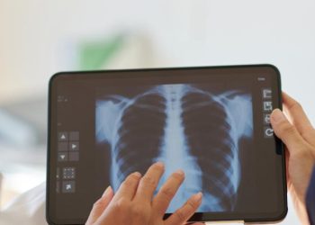 (VIDEO) Početkom godine nova metoda liječenja tumora u SKB Mostar