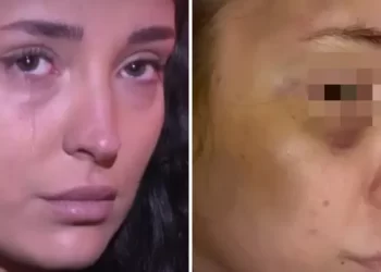 (VIDEO) Horor u BiH: Pretukao ženu jer ga je odbila, policija tražila da se umije da vide da nije šminka