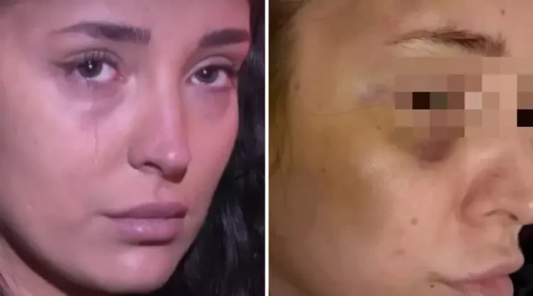 (VIDEO) Horor u BiH: Pretukao ženu jer ga je odbila, policija tražila da se umije da vide da nije šminka