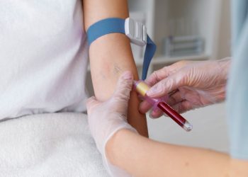 Što jesti dan prije vađenja krvi? Mnogi čine ove greške koje utječu na nalaz