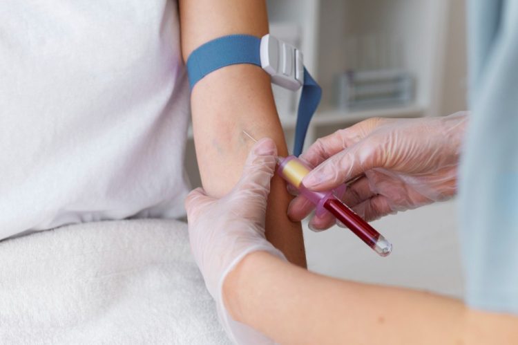 Što jesti dan prije vađenja krvi? Mnogi čine ove greške koje utječu na nalaz