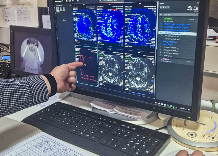 Nova dijagnostička metoda u SKB Mostar: Perfuzija mozga na magnetnoj rezonanci