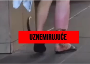 (VIDEO) Širi se opasna droga koja doslovno “jede” tijelo: Izaziva nekrozu, otvorene rane i smrtonosna predoziranja