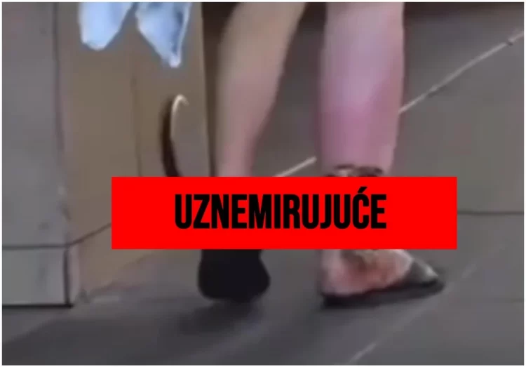 (VIDEO) Širi se opasna droga koja doslovno “jede” tijelo: Izaziva nekrozu, otvorene rane i smrtonosna predoziranja